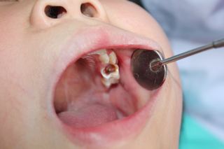 0-6歲兒童口腔清潔全攻略 科學選擇用品與養成衛生習慣